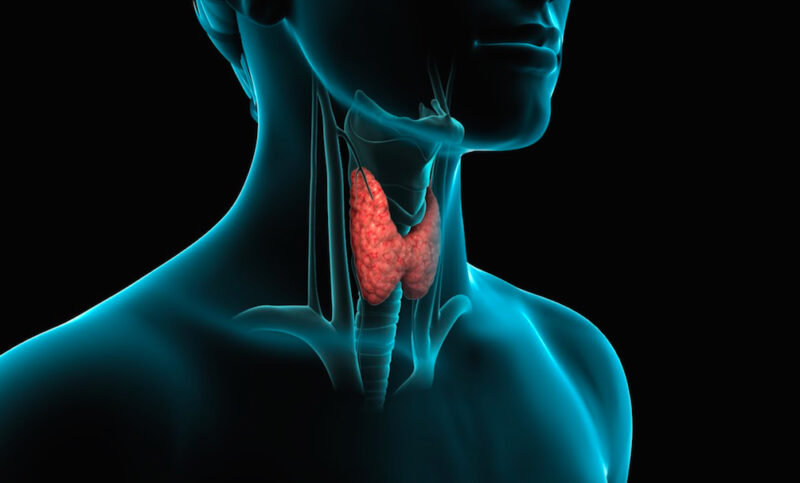 patologie della tiroide