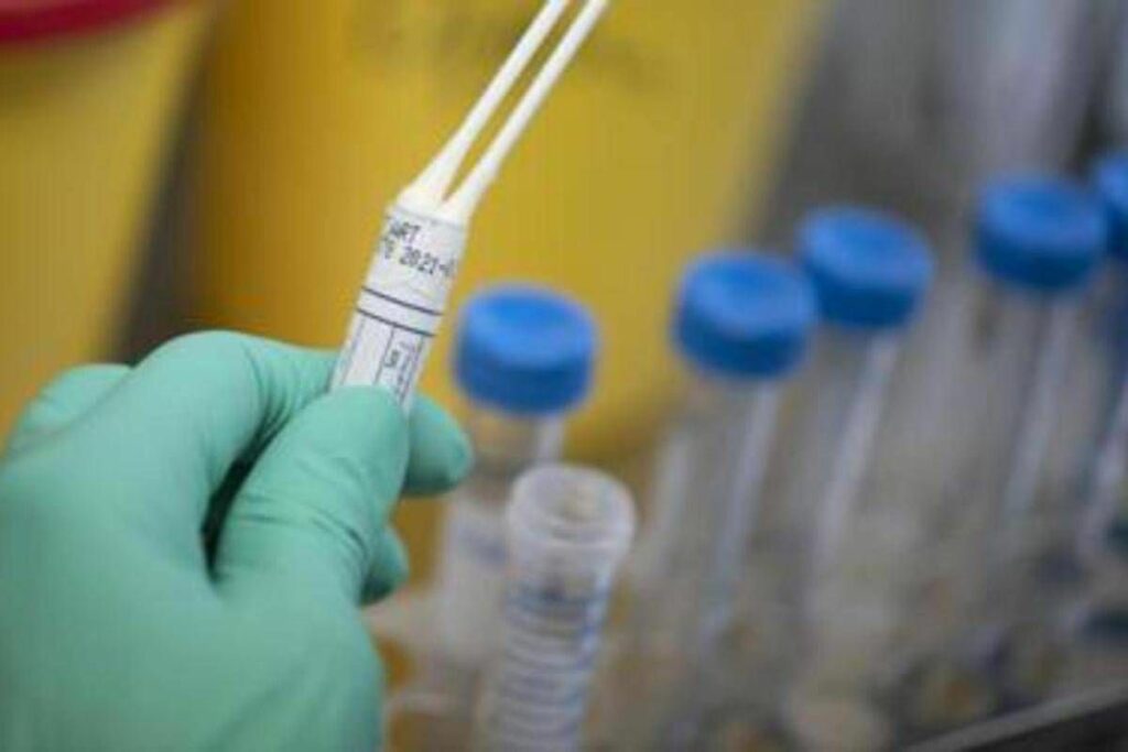 Legionella in case popolari a Milano un morto e diversi ricoverati Legionella in case popolari a Milano un morto e diversi ricoverati