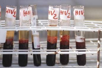 Salute da Hiv a infezioni sessuali lotta a sommerso al via settimana europea test Salute da Hiv a infezioni sessuali lotta a sommerso al via settimana europea test