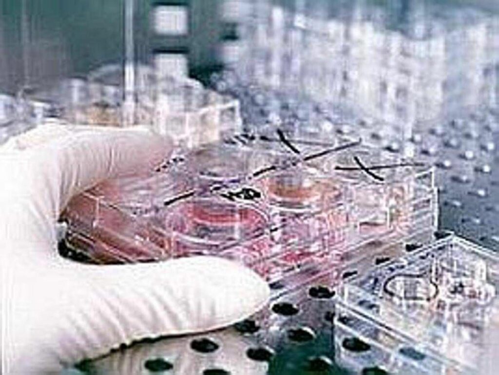 Fecondazione non solo endometriosi il nuovo protocllo che combatte ladenomiosi Fecondazione non solo endometriosi il nuovo protocllo che combatte ladenomiosi
