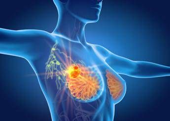 Per cancro seno la cura che arriva dal gelo Ieo Verso un futuro no bisturi Per cancro seno la cura che arriva dal gelo Ieo Verso un futuro no bisturi