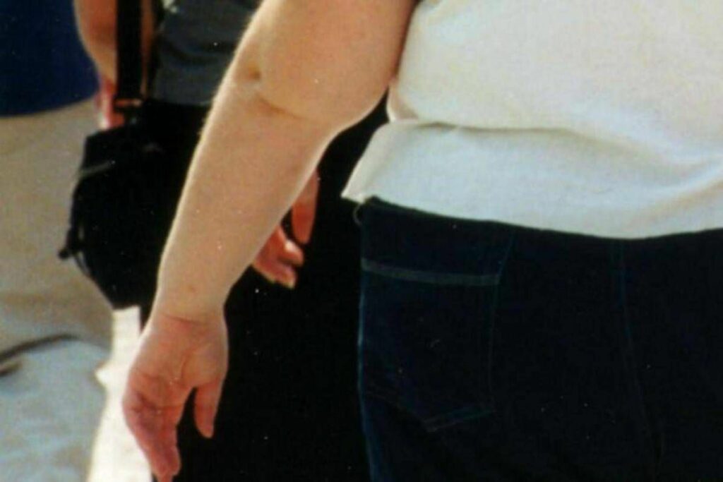 Salute allerta endocrinologi obesita triplicata in donne e raddoppiata in uomini Salute allerta endocrinologi obesita triplicata in donne e raddoppiata in uomini