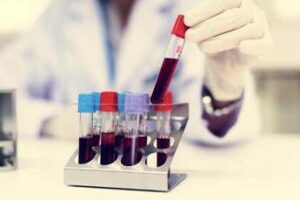 Nuovo tipo di diabete giovanile scoperto in Africa la conferma che cambia la storia in un maxi studio