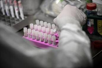 Covid casi in aumento a luglio anche il Sars CoV 2 ha rialzato la testa Covid casi in aumento a luglio anche il Sars CoV 2 ha rialzato la testa