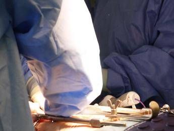 Diverbio in sala operatoria parla il professor Sica Li si combatte tra vita e morte Diverbio in sala operatoria parla il professor Sica Li si combatte tra vita e morte