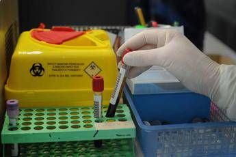 Alzheimer via libera a test del sangue per diagnosi cosa significa Alzheimer via libera a test del sangue per diagnosi cosa significa