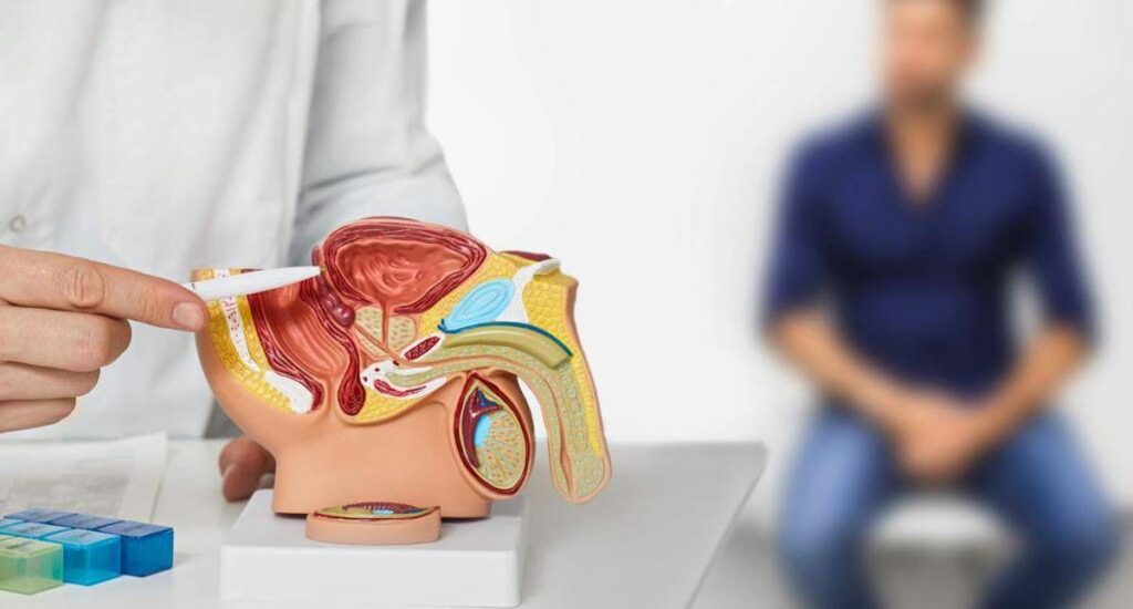 Cancro prostata avanzato Ema raccomanda terza indicazione per darolutamide Cancro prostata avanzato Ema raccomanda terza indicazione per darolutamide