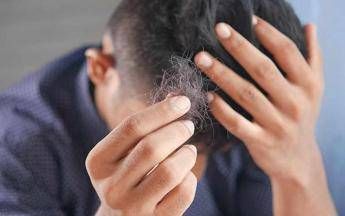 Il dermatologo Con alopecia areata disagi e costi alti svecchiare linee guida Il dermatologo Con alopecia areata disagi e costi alti svecchiare linee guida