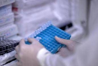Melanoma glicemia alta dimezza la sopravvivenza in pazienti senza diabete Melanoma glicemia alta dimezza la sopravvivenza in pazienti senza diabete