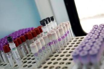Mielofibrosi speranze da nuovo farmaco che limita lanemia in 2 pazienti su 3 Mielofibrosi speranze da nuovo farmaco che limita lanemia in 2 pazienti su 3