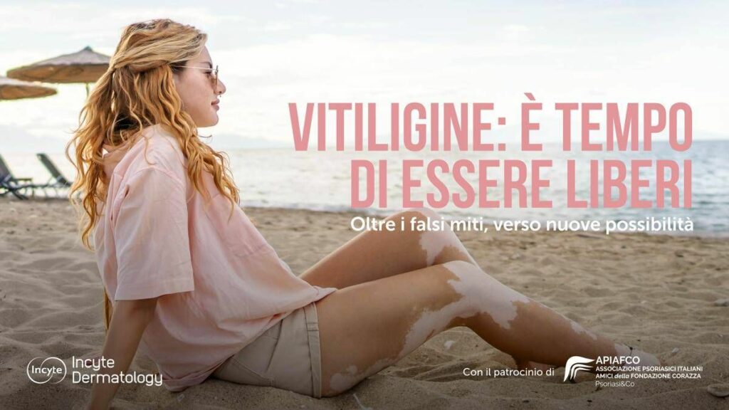 Salute Giornata vitiligine al via campagna Oltre falsi miti verso nuove possibilita Salute Giornata vitiligine al via campagna Oltre falsi miti verso nuove possibilita