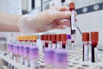 Sibioc su ipotesi Regione Lazio No esternalizzazione medicina di laboratorio Sibioc su ipotesi Regione Lazio No esternalizzazione medicina di laboratorio