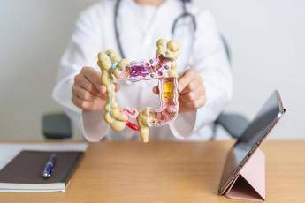 Tumori Garufi San Camillo Il tumore del colon retto si puo prevenire ma ladesione agli screening e troppo bassa Tumori Garufi San Camillo Il tumore del colon retto si puo prevenire ma ladesione agli screening e troppo bassa