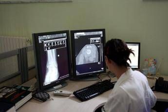 Un italiano su 4 e over 65 Sirm Prevenzione personalizzata con radiologia geriatrica Un italiano su 4 e over 65 Sirm Prevenzione personalizzata con radiologia geriatrica