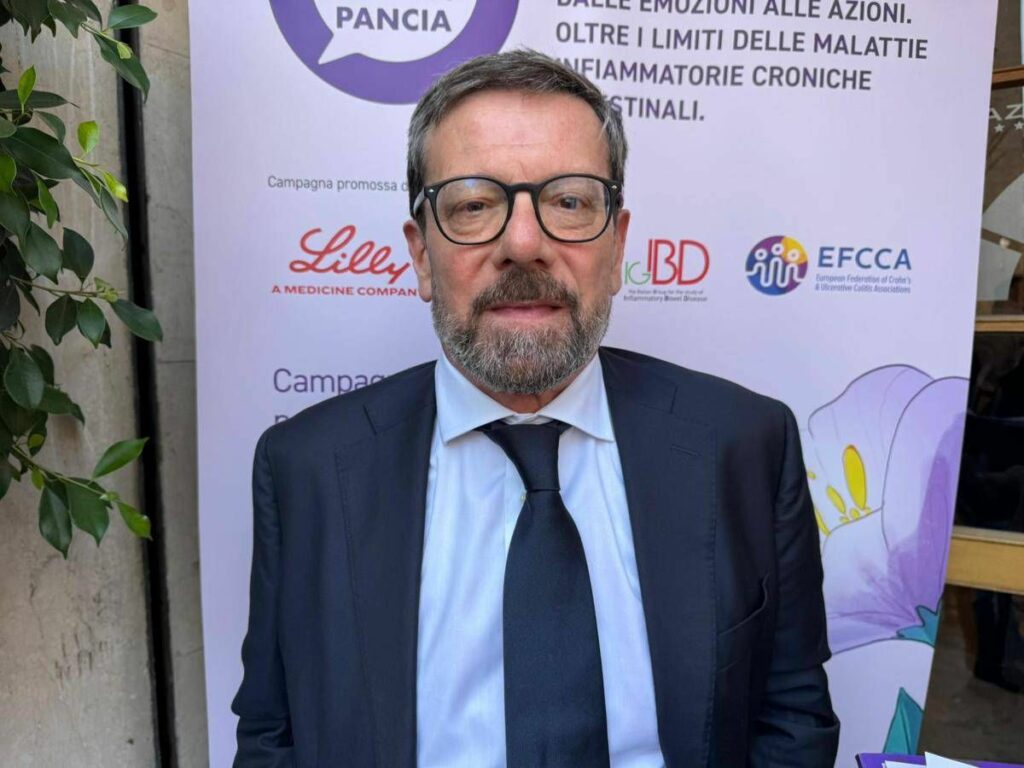 Armuzzi Humanitas In Italia 260mila persone con Mici diagnosi precoce fondamentale Armuzzi Humanitas In Italia 260mila persone con Mici diagnosi precoce fondamentale