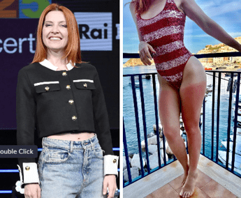 Dalla chioma alle gambe Noemi ironizza sulla scottatura Mai senza crema Dalla chioma alle gambe Noemi ironizza sulla scottatura Mai senza crema